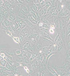 769-P人腎細(xì)胞腺癌細(xì)胞主圖