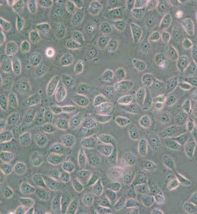 5637人膀胱癌細胞主圖
