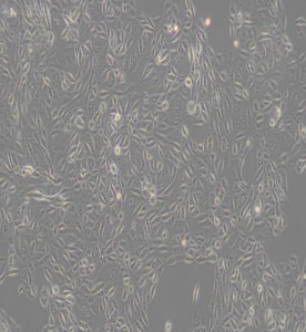 ACHN人腎細胞腺癌細胞主圖