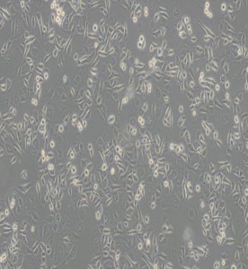 AGS人胃腺癌細胞主圖