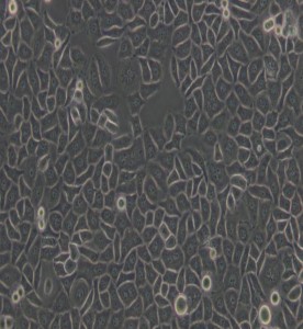 Bcap-37人乳腺癌細胞主圖