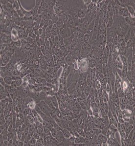 CFPAC-1人胰腺癌細胞主圖