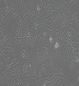 DLD-1人結直腸腺癌上皮細胞主圖