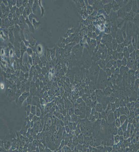 FaDu人咽鱗癌細胞主圖