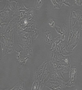 HT1080人纖維肉瘤細胞主圖