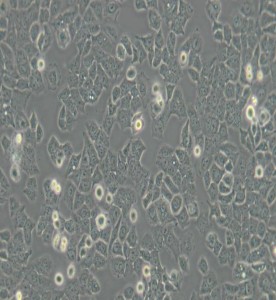 Ishikawa人子宮內(nèi)膜癌細(xì)胞主圖