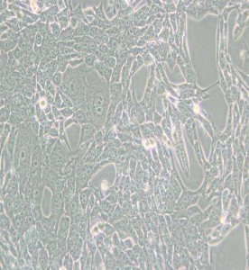 RENCA小鼠腎癌細胞主圖