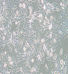 P19小鼠畸胎瘤細胞主圖