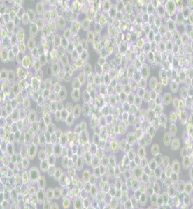 P3X63Ag8小鼠骨髓瘤細胞主圖