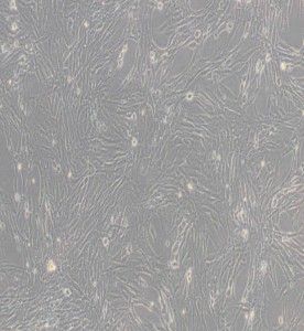 BHK-21倉(cāng)鼠腎成纖維細(xì)胞主圖