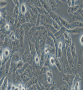 NCI-H1703人肺鱗癌細(xì)胞主圖
