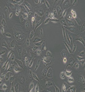 OS-RC-2人腎癌細(xì)胞主圖