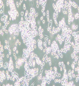 B95-8絨猴EB病毒轉(zhuǎn)化的白細胞主圖