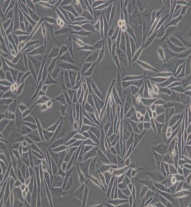 SiHa人子宮頸鱗癌細胞主圖