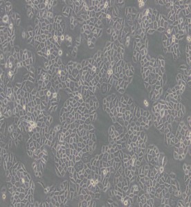 SPC-A-1人肺腺癌細胞主圖