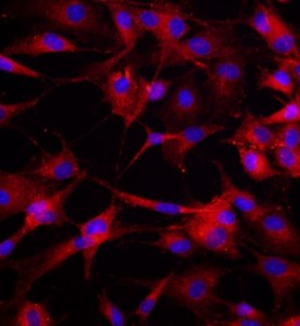 大鼠骨髓來源內皮祖細胞主圖