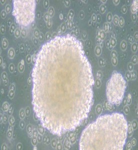 NK-92人惡性非霍奇金淋巴瘤患者的自然殺傷細胞主圖