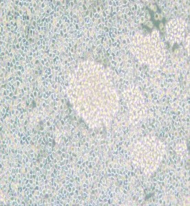 Reh人急性非B非T淋巴細胞白血病主圖