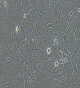 SW 1353人軟骨肉瘤細(xì)胞(DMEM） 主圖