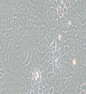 TE-10人食管癌細(xì)胞主圖