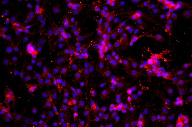 小鼠肝竇內(nèi)皮細(xì)胞主圖