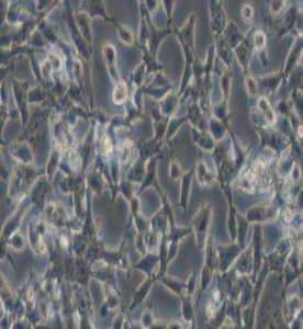 D283 Med人腦髓母細(xì)胞瘤細(xì)胞主圖