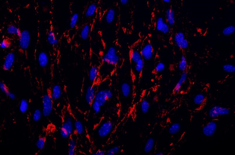 小鼠腦微血管內皮細胞主圖