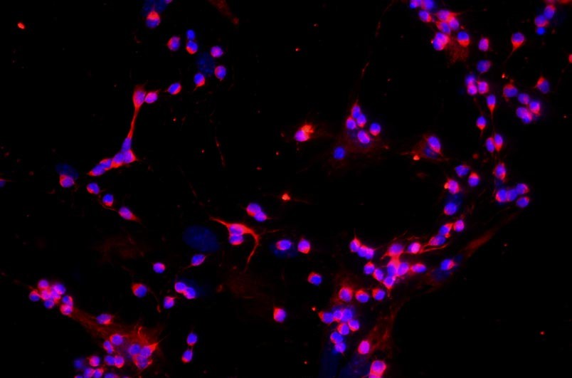 小鼠視網膜神經節(jié)細胞主圖