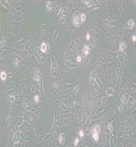 Caov-3人乳突狀卵巢腺癌細胞主圖