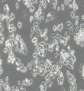 CW-2人結(jié)腸腺癌細(xì)胞主圖