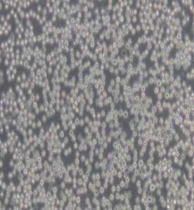 Daudi人Burkitt's淋巴瘤細胞主圖