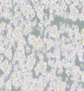 EB-3人Burkitt's淋巴瘤細胞主圖