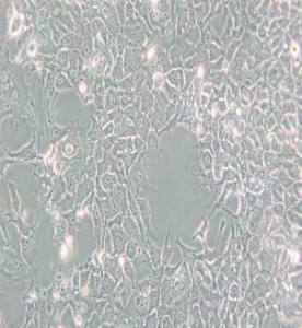 HCC827人非小細胞肺癌細胞主圖