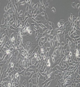MDA-MB-415人乳腺癌細(xì)胞(DMEM) 主圖