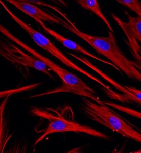 人牙周膜成纖維細胞主圖