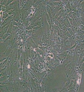 PED豬內皮細胞主圖