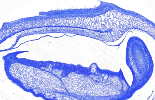 甲苯胺藍(lán)染色(肥大細(xì)胞)主圖