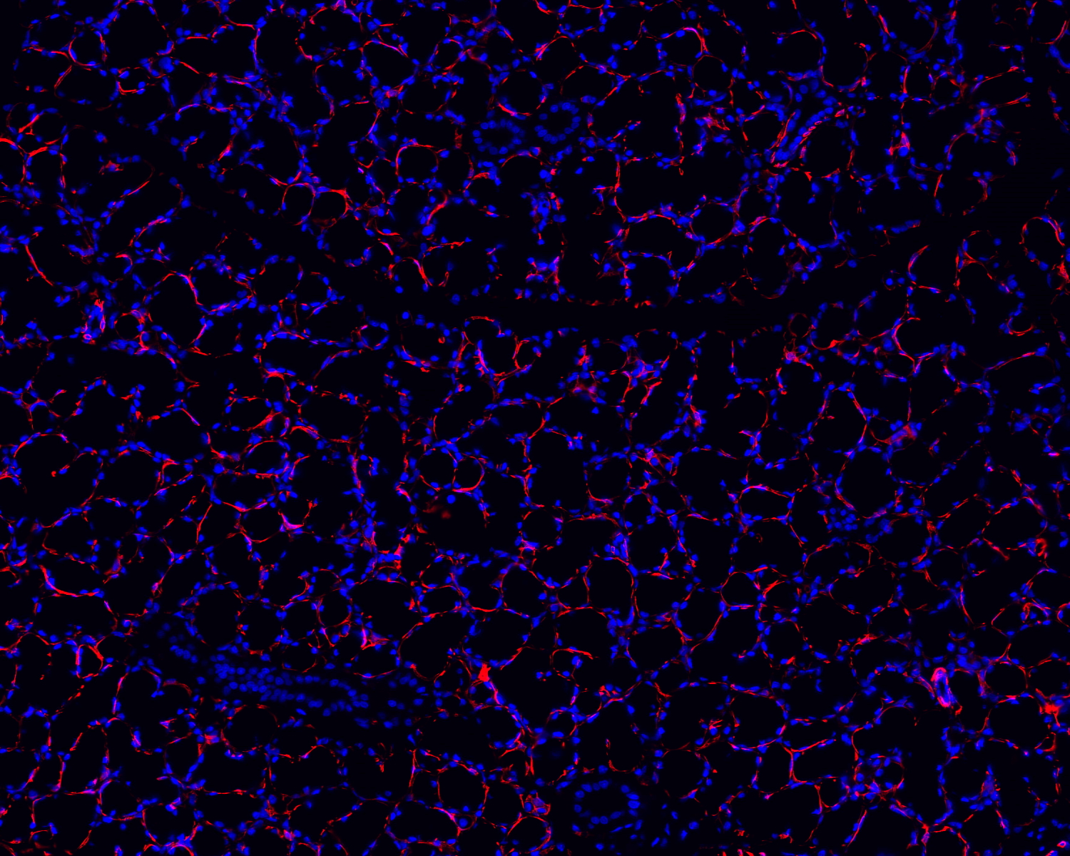 免疫熒光單標雙色染色主圖