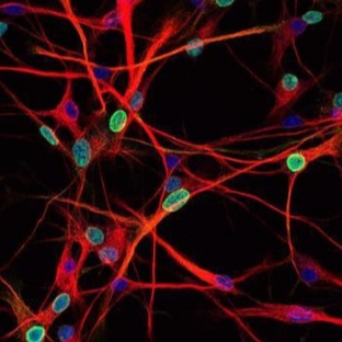 切片全景掃描（熒光雙標三色）主圖